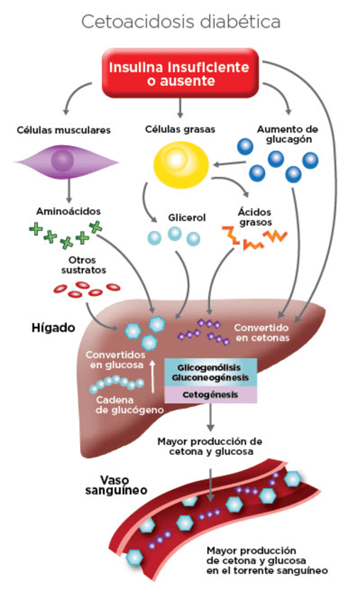 Cetoacidosis-Diabetica.pdf