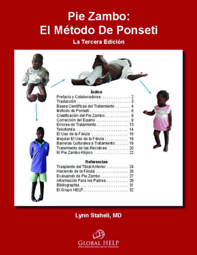 Tema-3-Metodo-Ponseti.pdf