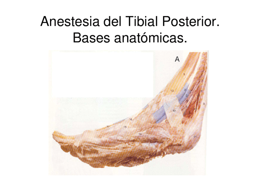Tema-1-Anestesia-Tibial-Posterior.pdf