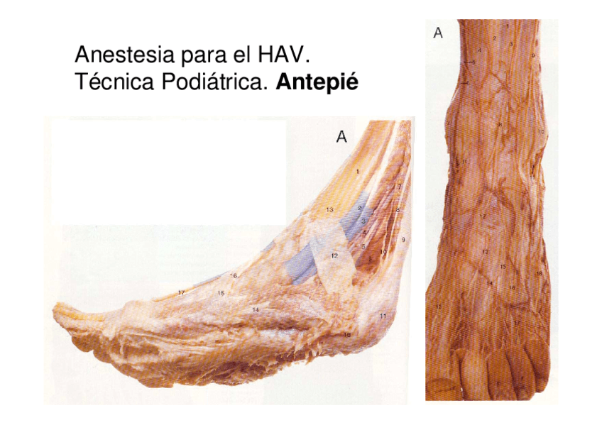 Tema-1.1-Anestesia-HAV-tecnica-podiatrica.pdf