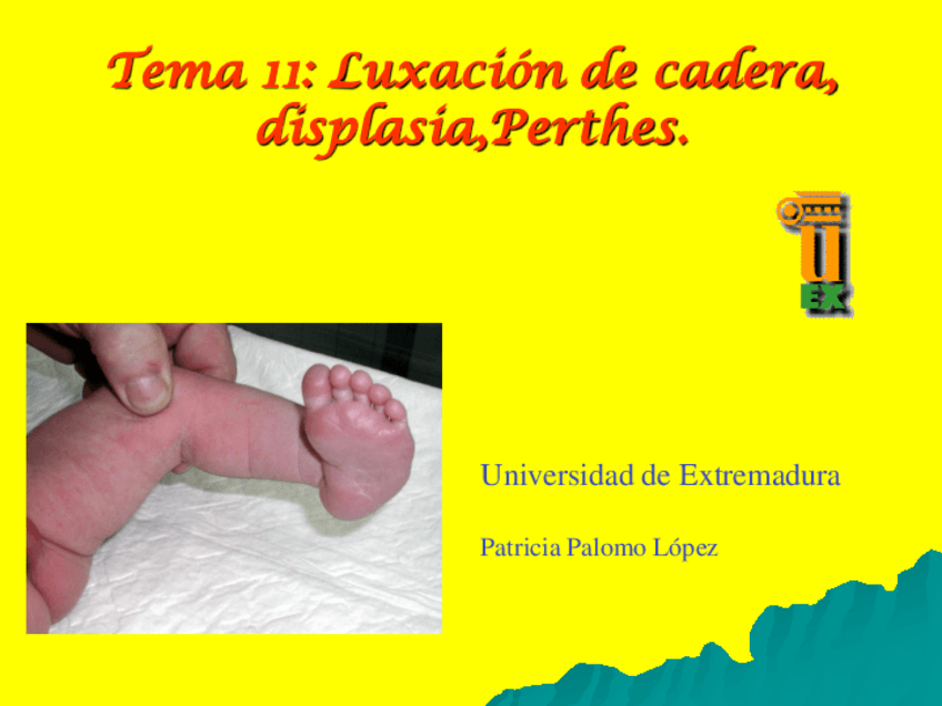 Tema-11-Luxacion-de-cadera-displasia-Perthes.pdf