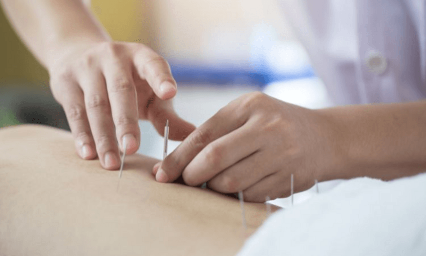 acupuntura-puntos.pdf