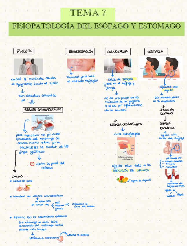 TEMA-7-Fisiopatologia-del-esofago-y-estomago.pdf