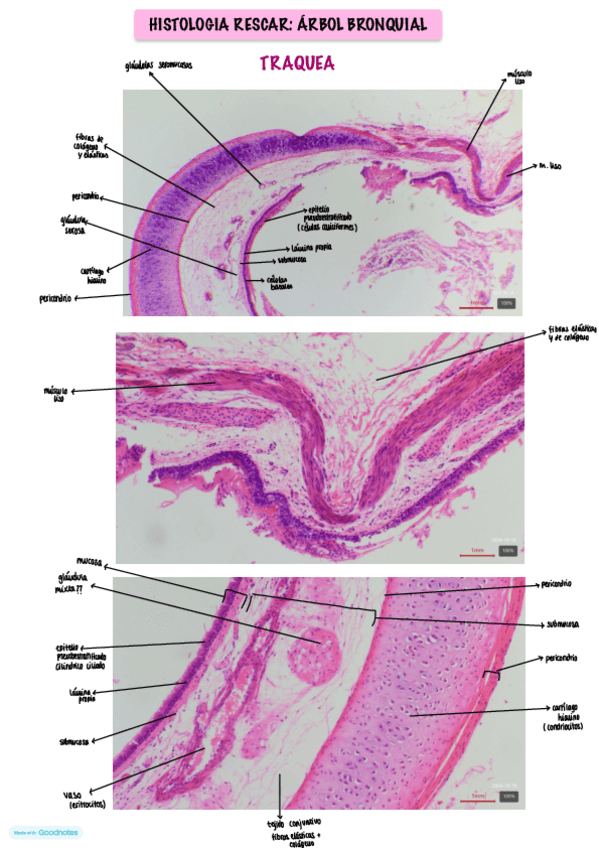 Histologia-traquea--pulmones.pdf