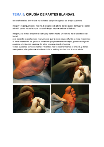 TEMA 22_ CIRUGÍA DE PARTES BLANDAS.pdf