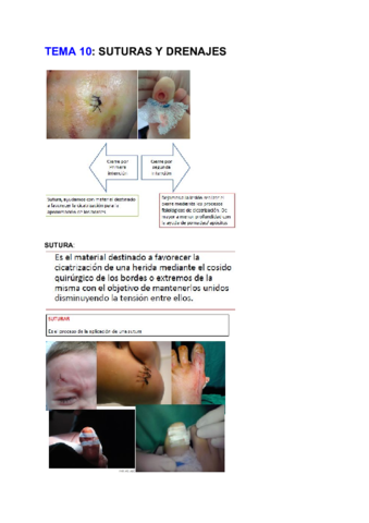 TEMA 10_ SUTURAS Y DRENAJES.pdf