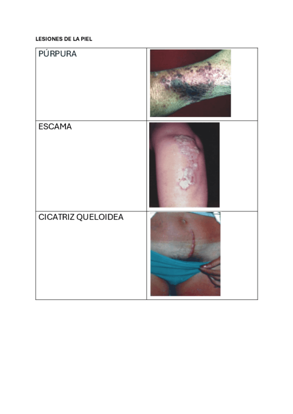 TABLA-LESIONES.pdf