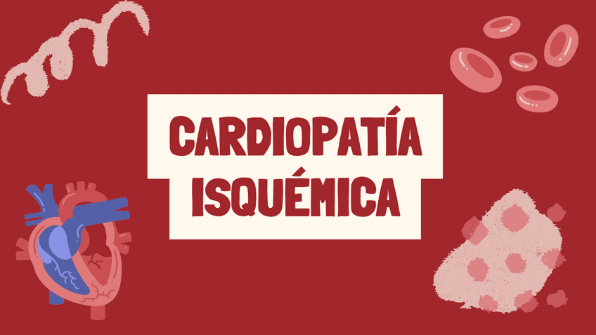 Cardiopatia-Isquemica.pdf