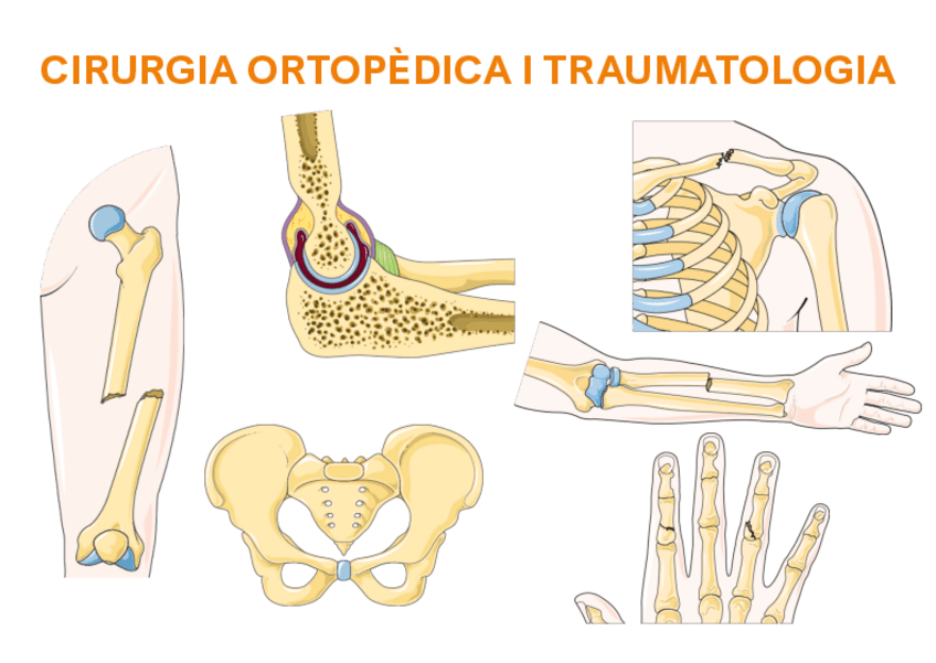 RESUMS-PRIMER-PARCIAL-trauma.pdf