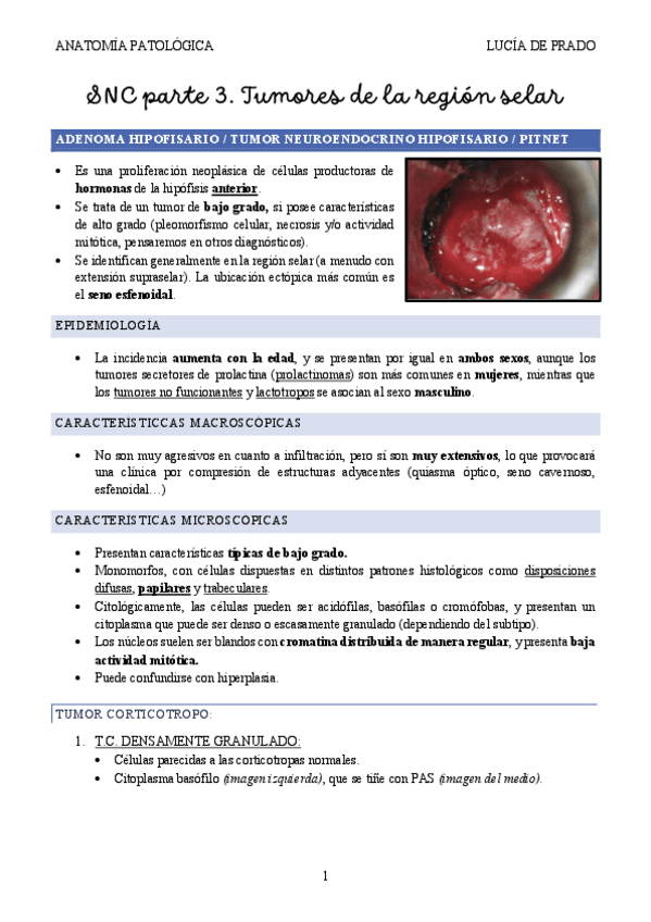 SNC-parte-3.-TUMORES-HIPOFISIS-24-25.pdf