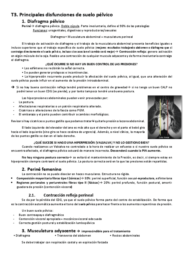 T3.-Preventiva.pdf