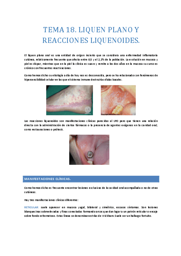 TEMA-18.-liquen-plano-y-reacciones-liquenoides.-Esquemas.pdf