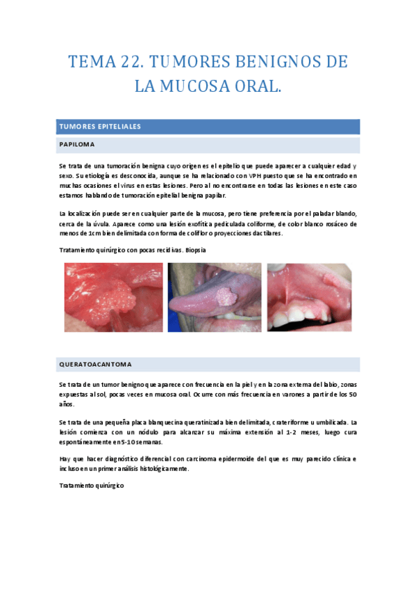 TEMA-22.-Tumores-beningnos-de-la-cavidad-oral.-Esquemas.pdf