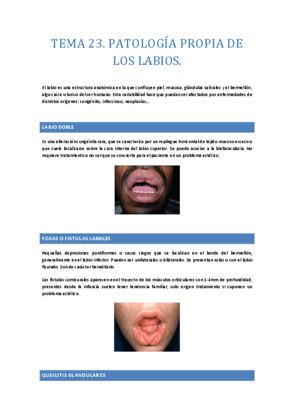 TEMA-23-patologia-propia-de-los-labios.-Esquemas.pdf
