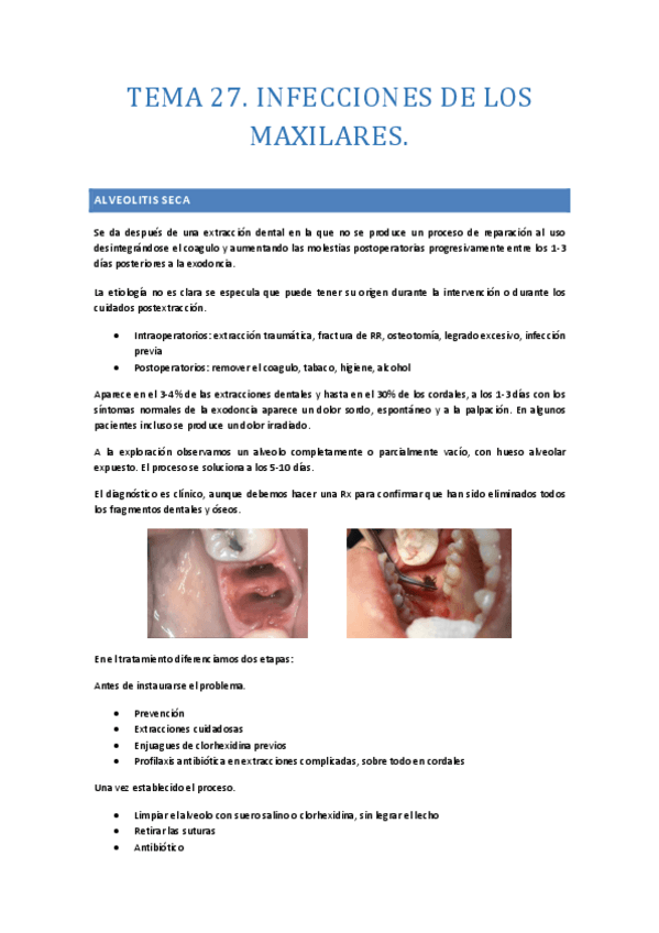 TEMA-27-.-infecciones-de-los-maxilares.-Esquemas.pdf