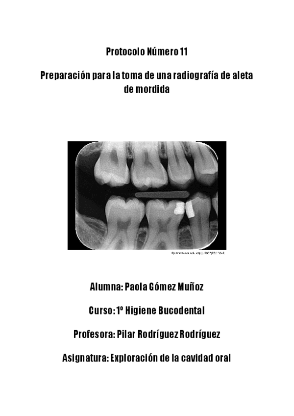 Protocolo-EXCO-11.pdf