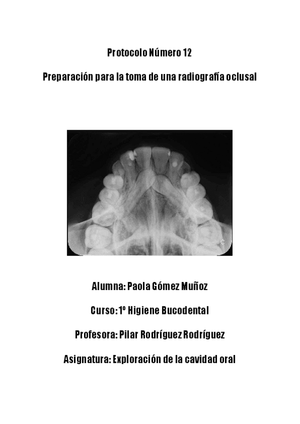 Protocolo-EXCO-12.pdf