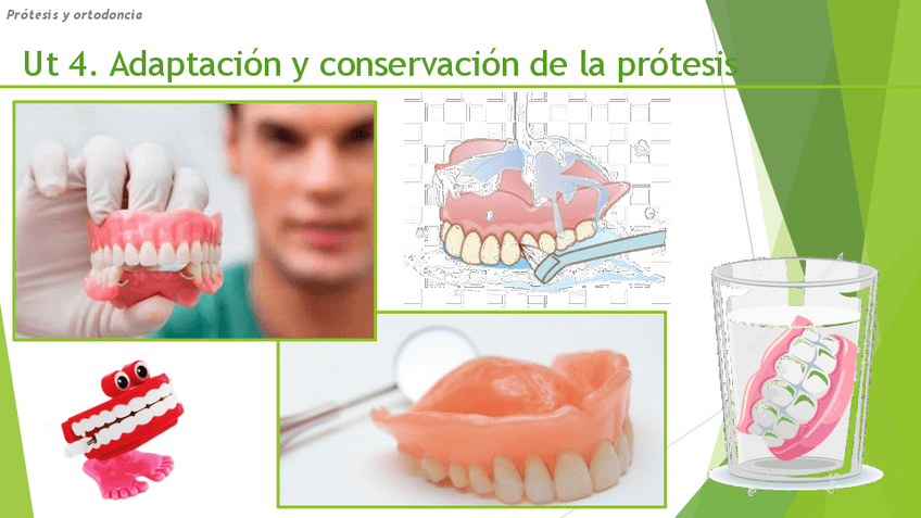 UT4Adaptacion-y-conservacion-de-la-protesisAlumnado.pdf