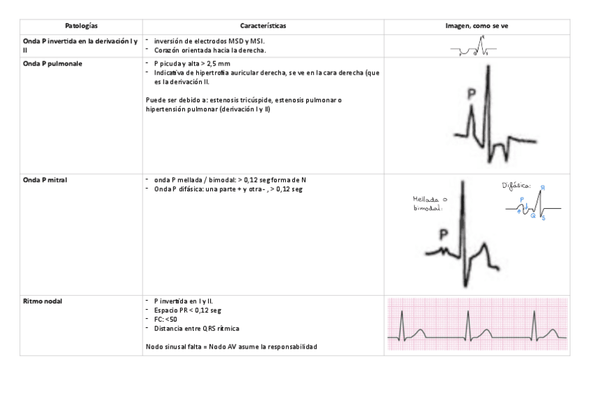 Tabla-resumen-EKG-completa.pdf