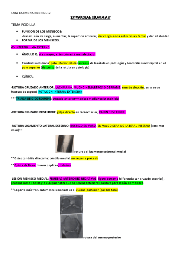 2o-PARCIAL-TRAUMA-II-rodilla.pdf