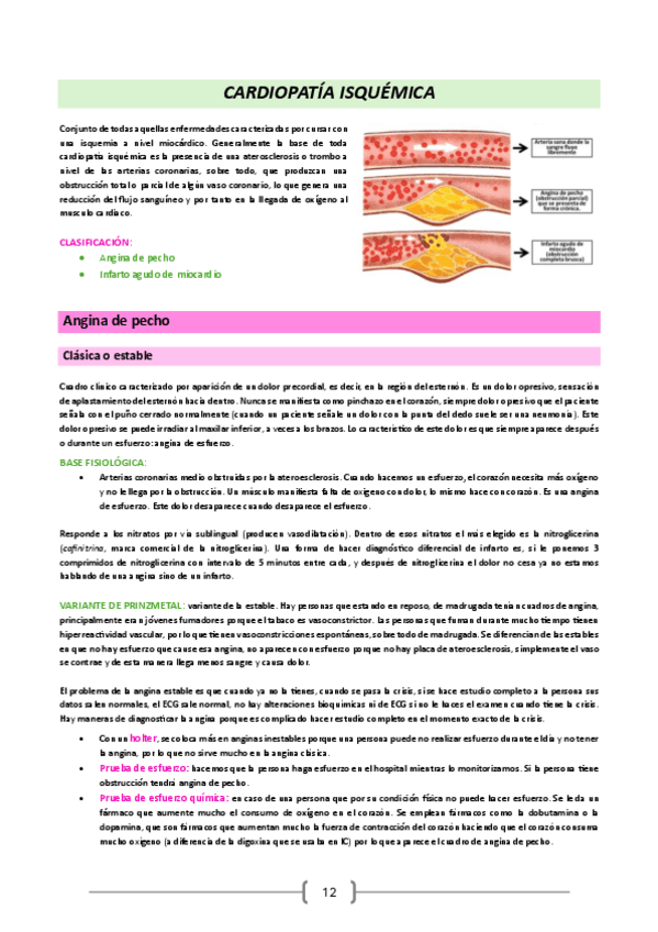 PMG-24-25.-Cardiopatia-isquemica.pdf