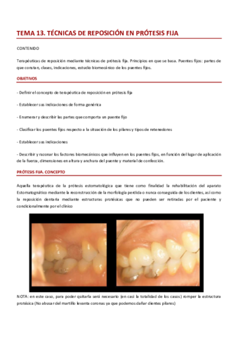TEMA 13 PRÓTESIS II.pdf