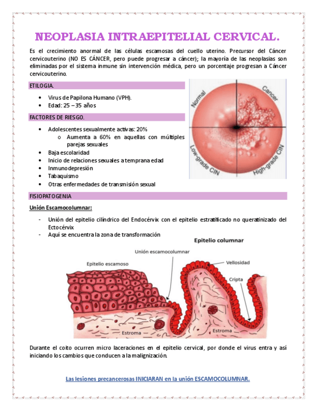 Neoplasia-Intraepitelial-Cervical-VPH.pdf