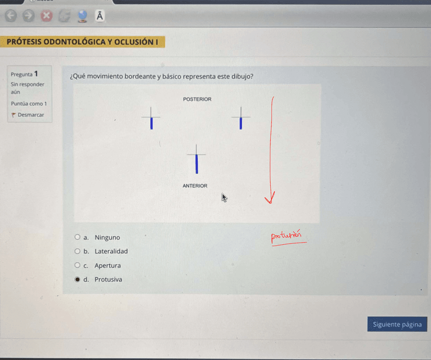 prothese-s1-janvier.pdf