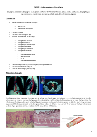 Tema 1. Enfermedades del esófago.pdf