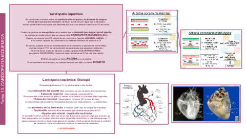 SEMIO Tema 13 14 Cardiopatia isquemica.pdf