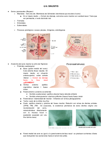 Q18. Sinusitis. 2018.2019.pdf