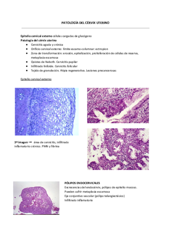 Cancer cervix.pdf