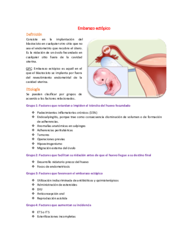 24 Embarazo ectópico.pdf