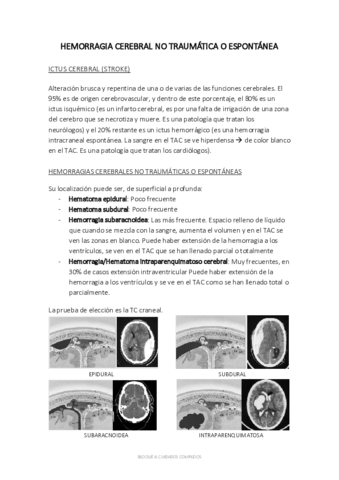 B2. TEMA 25. HEMORRAGIA CEREBRAL NO TRAUMÁTICA O ESPONTÁNEA.pdf