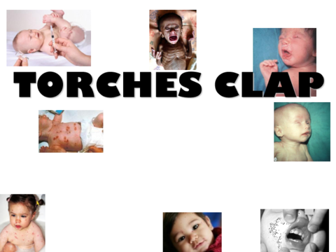 10.-TORCHES-CLAP.pdf