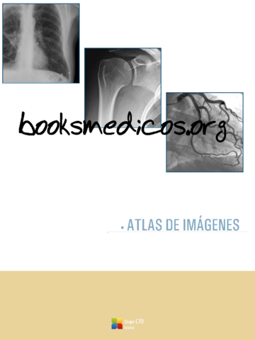 382991426-Atlas-de-Imagenes-CTO-pdf.pdf