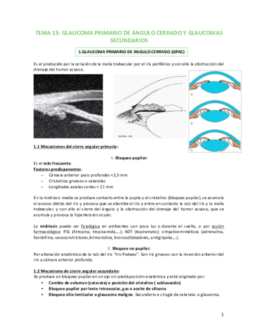 Tema-13-Glaucoma-primario-de-angulo-cerrado-y-glaucomas-secundarios-.pdf