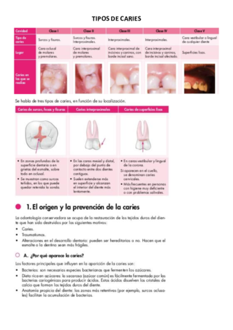 TIPOS-DE-CARIES.pdf