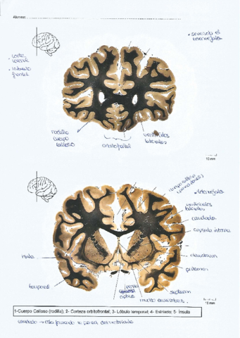 Neuroanatomia.pdf