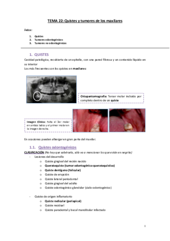 Tema 22 Quistes y Tumores Maxilares.pdf