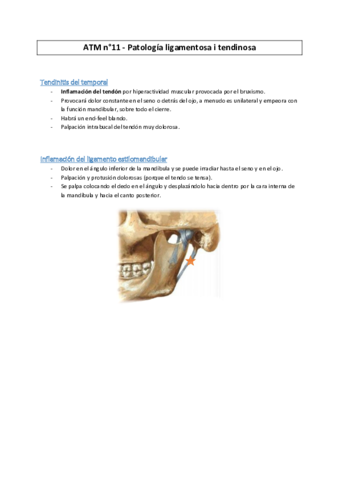 ATM-11-Patologia-ligamentosa--MC2016.pdf