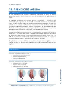 T5. Apendicitis Aguda.pdf