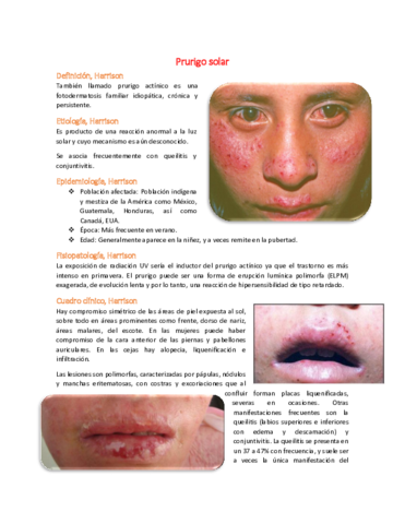 9-Prurigo-solar.pdf
