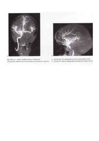 Angiografia-arteria-carotida.pdf