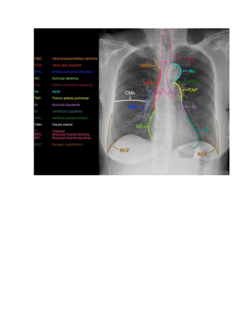 Estructuras-del-mediastino.pdf
