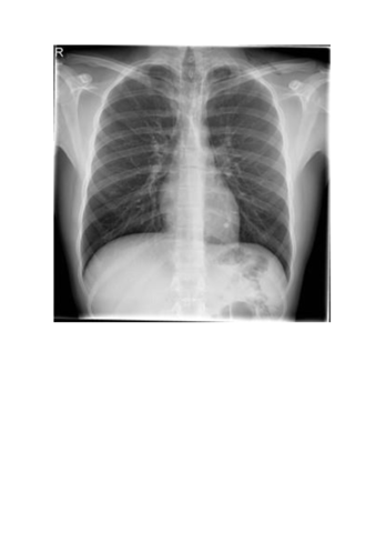 Radiografia-Torax.pdf