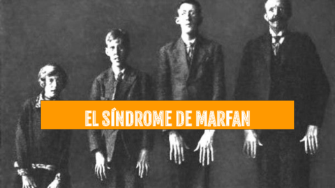 EL-SINDROME-DE-MARFAN.pdf