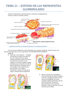 Tema 21.pdf