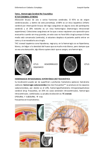 Hemorragia-cerebral-no-traumatica-imp.pdf