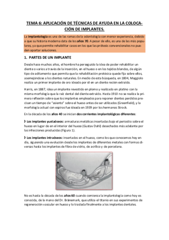 Tema-6-Aplicacion-de-tecnicas-de-ayuda-en-la-colocacion.pdf